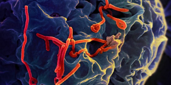 Ébola 2 por NIAID